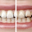 before-after-image